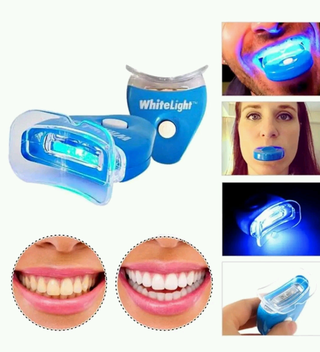 Kit pâte Violette & led UV